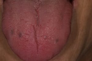 Img 1663 zgsstb - Eugenol