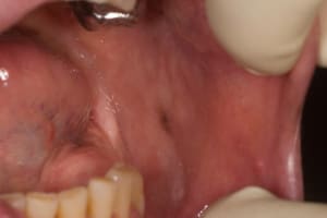 Img 1667 hlbutp - Eugenol