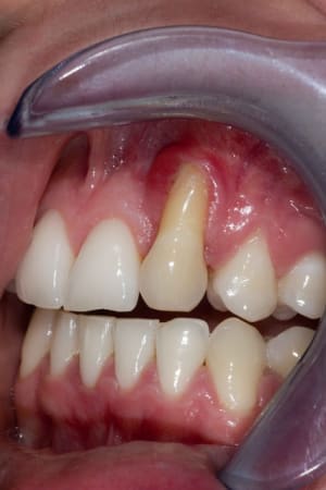 Img 1812 q65c13 - Eugenol