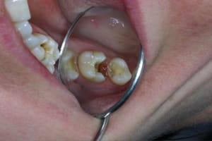 Img 1835 afxw72 - Eugenol