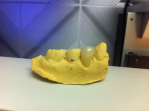 Img 1874 squjqp - Eugenol