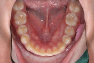 Img 1 xacnga - Eugenol