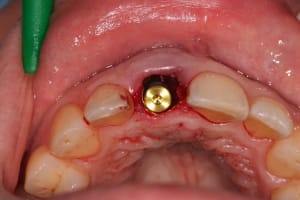 Img 2011 jcwphp - Eugenol
