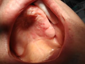 Img 20160303 145834 sqcmdt - Eugenol