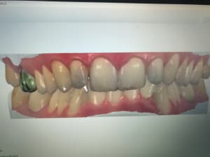 Img 20170420 155353 s4oady - Eugenol