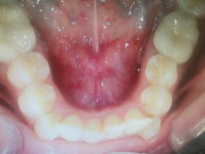 Img 20171129 145734 t6eikw - Eugenol