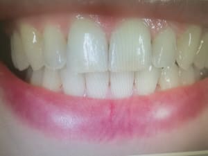 Img 20171129 145749 f6lqpi - Eugenol