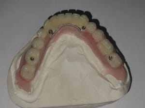Img 20200219 165615 rpdary - Eugenol