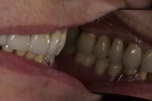 Img 2088 cmsgnq - Eugenol