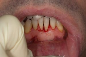 Img 2179 dpaazt - Eugenol