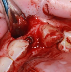 Img 2254 vrvkqq - Eugenol