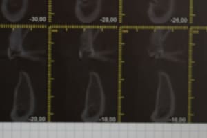 Img 2385 fe5vcs - Eugenol