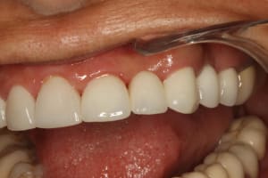 Img 2605 mippmo - Eugenol