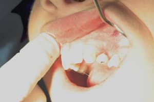 Img 2680 nj0cce - Eugenol