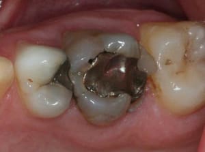 Img 2731 apfcja - Eugenol