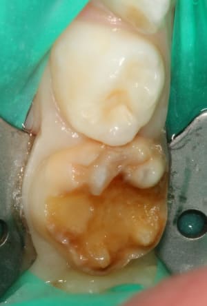 Img 2797 lfyfzb - Eugenol