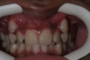 Img 2 icjhvq - Eugenol