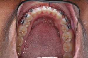 Img 2 jo9igy - Eugenol
