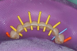 Img 2 siytdm - Eugenol