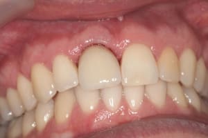 Img 3106 d2rlpg - Eugenol