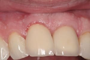 Img 3108 haqvx5 - Eugenol