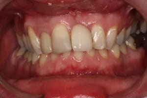 Img 3276 qzbokb - Eugenol