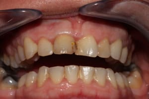 Img 3514 lllkxg - Eugenol
