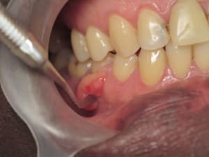 Img 3631 lovvhf - Eugenol
