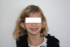 Img 3653 j3ojno - Eugenol