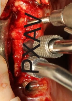Img 3746rcopyright qq5x1b - Eugenol