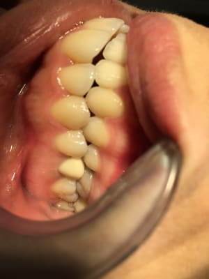 Img 3986 ozjcj8 - Eugenol