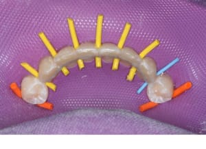 Img 3 ituagt - Eugenol