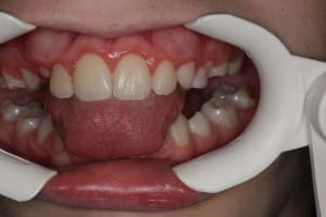 Img 3 rlovt4 - Eugenol