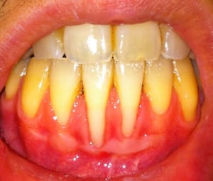 Img 4017 xp61qc - Eugenol