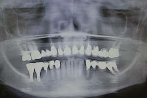 Img 4152 h6s5s5 - Eugenol