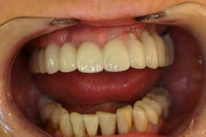 Img 4312 oxjxm2 - Eugenol