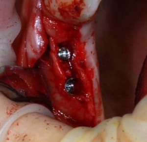 Img 4355 wjoss1 - Eugenol