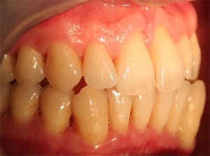 Img 4505 fh86ux - Eugenol