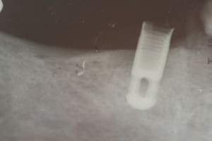 Img 4592 wzudjt - Eugenol
