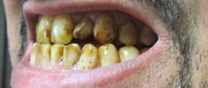 Img 4600 avdojv - Eugenol