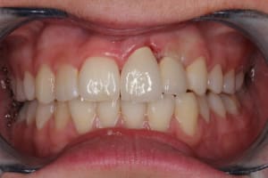 Img 4753 semqe4 - Eugenol