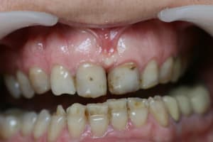 Img 4770 alqj1p - Eugenol