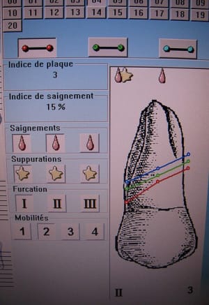 Img 4816 povbcw - Eugenol