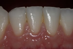 Img 4957 jtt86v - Eugenol