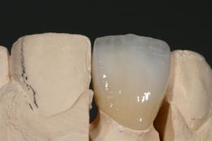 Img 5793  large  lxez3e - Eugenol