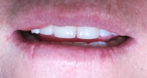 Img 5813 bhh1tm - Eugenol