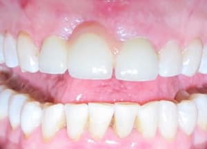 Img 5820 kowclt - Eugenol