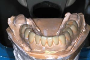 Img 5954 corwbg - Eugenol