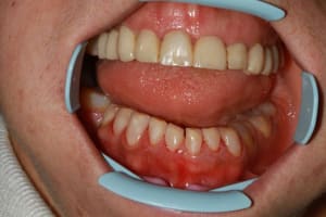 Img 5975 1 kbzcyp - Eugenol