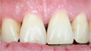 Img 6029 nzdiqh - Eugenol